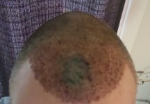 Hair(2).jpg